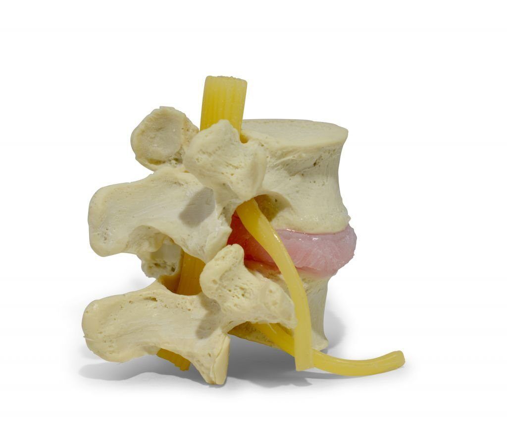 Lumbar Vertebrae 3D Model | Classic LxH Dynamic Disc Model